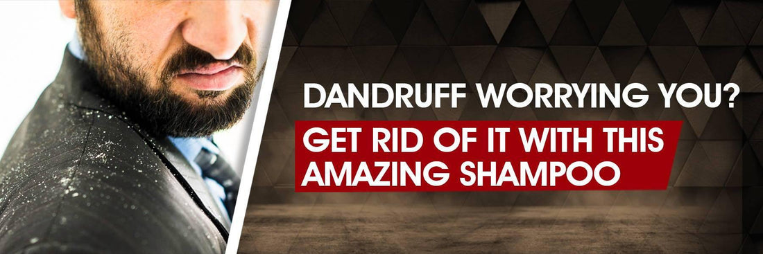Dandruff worrying you? Get rid of it with this Amazing Shampoo - UrbanGabru