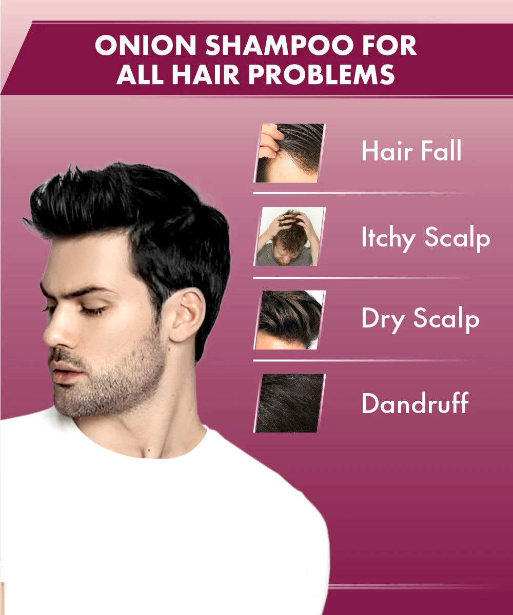 Urbangabru Onion Shampoo for all hair problems - UrbanGabru