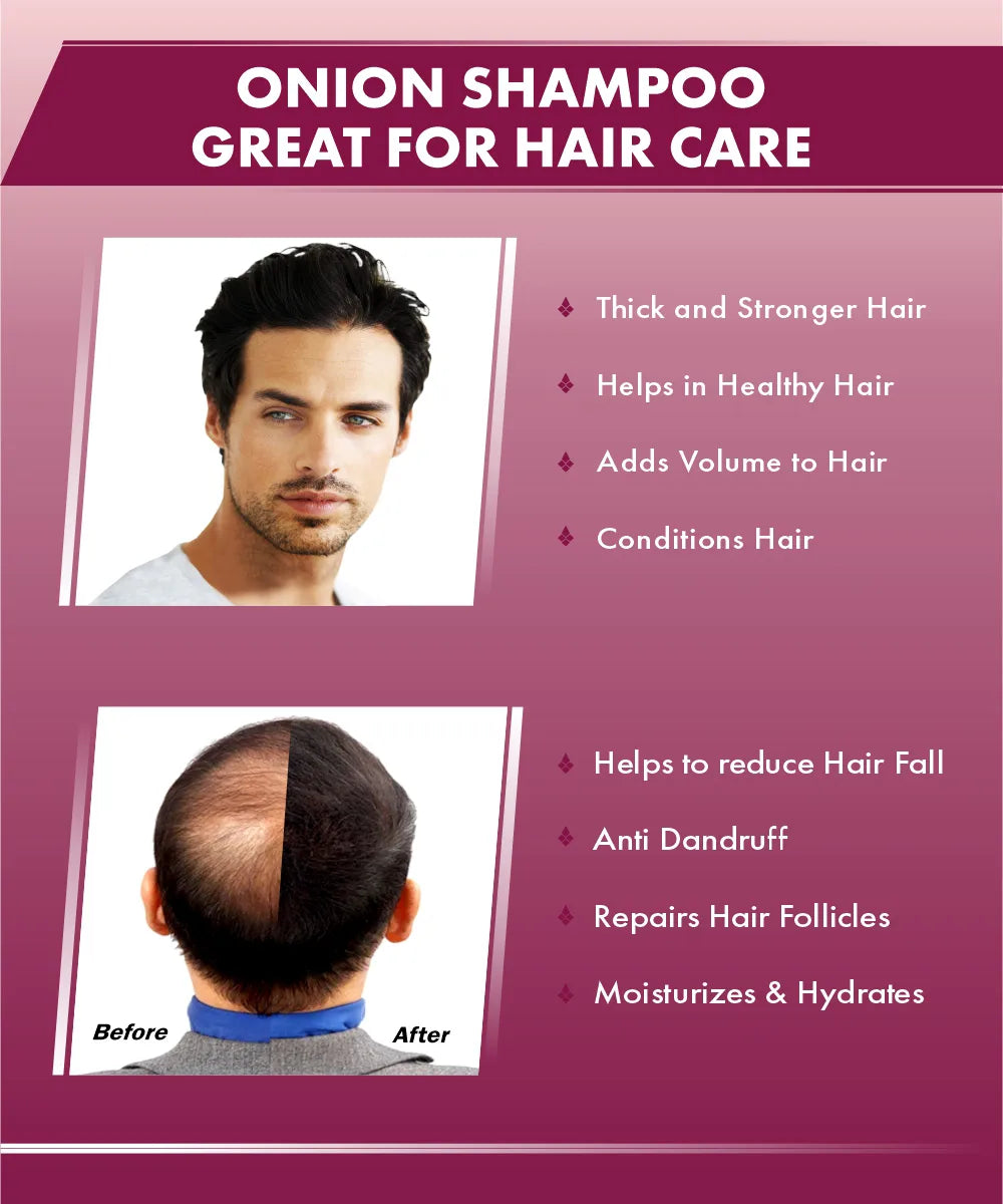Urbangabru Onion Shampoo great for hair care - UrbanGabru