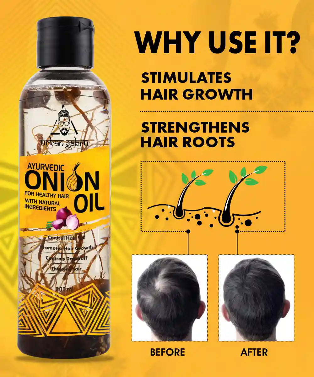 Top Rated Onion Oil For Hair Growth In 2022 | LBB