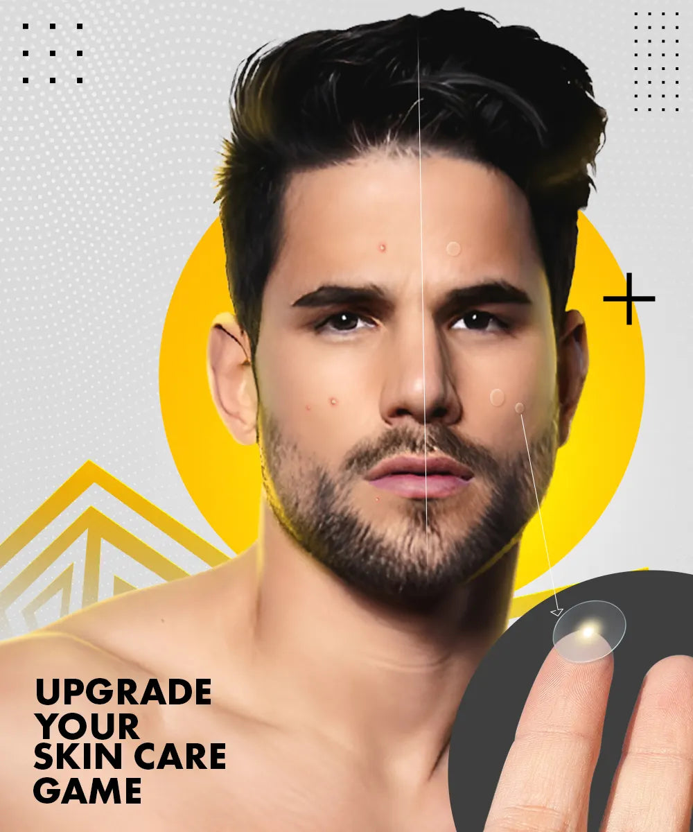 Urbangabru Acne Pimple Patch upgrade your skin care game -  Urbangabru