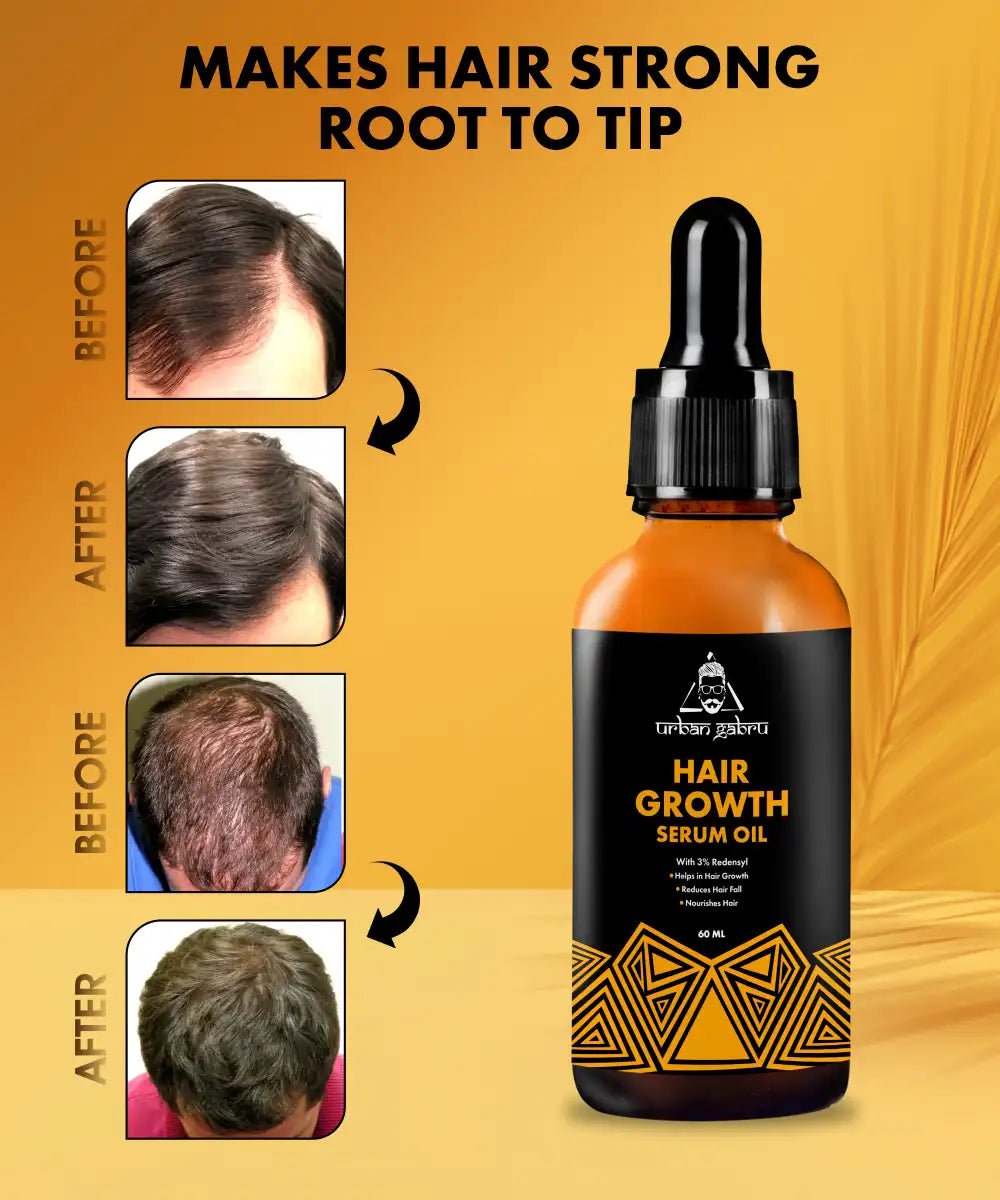 Urbangabru Hair Growth Serum Oil makes hair strong root to tip - Urbangabru